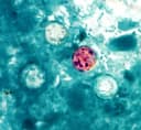 Michigan đối mặt với đợt bùng phát ký sinh trùng Cyclospora: Hơn 700 ca nhiễm và những cảnh báo y tế quan trọng