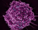 Đột phá y sinh: Vaccine HIV thế hệ mới đạt hiệu quả chưa từng có trong thử nghiệm tiền lâm sàng